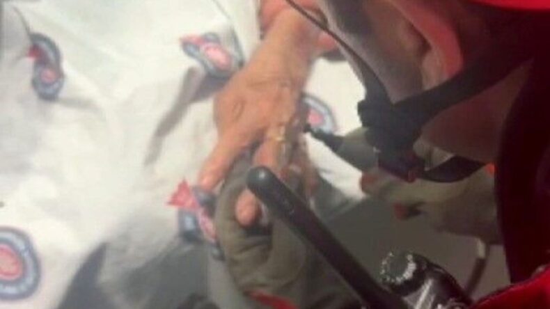 Hatay’da Hastanın Parmağına Sıkışan Yüzük Müdahale Edildi