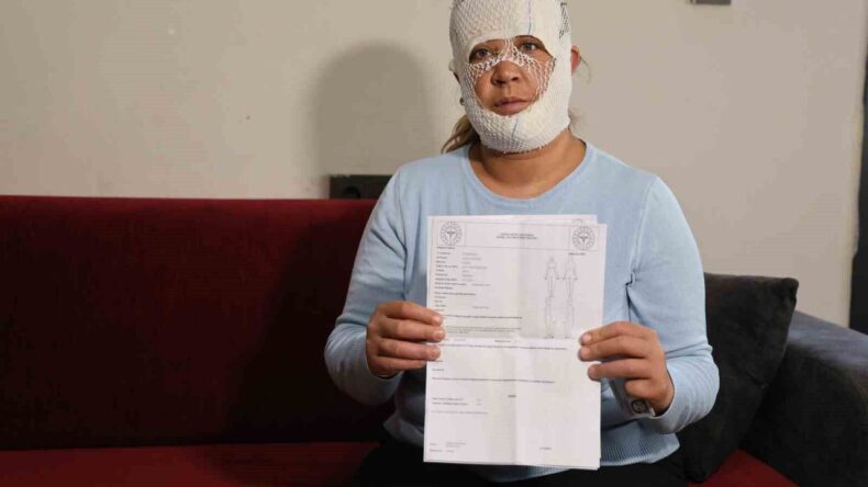 Adana’da Güzellik Merkezinde Yüzü Yanan Kadın Mağdur Oldu