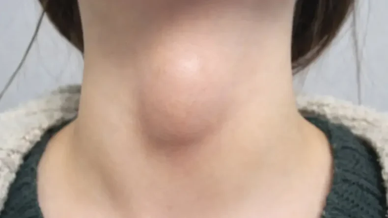 Herkes Kullanıyor: Tiroidi Tehdit Ettiği Ortaya Çıktı!