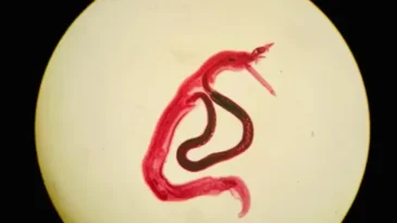 Hatay’da Cinsel Yolla Bulaşan Enfeksiyon Alarmı: Uzmanlardan Hastalık Uyarısı